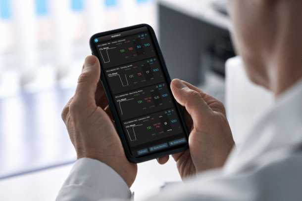 Get cardiac, NIRS, and vent alarms on your phone