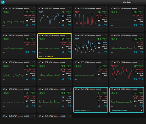 Unify & improve performance metrics