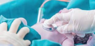 baby in the NICU
